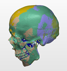 point cloud skull model